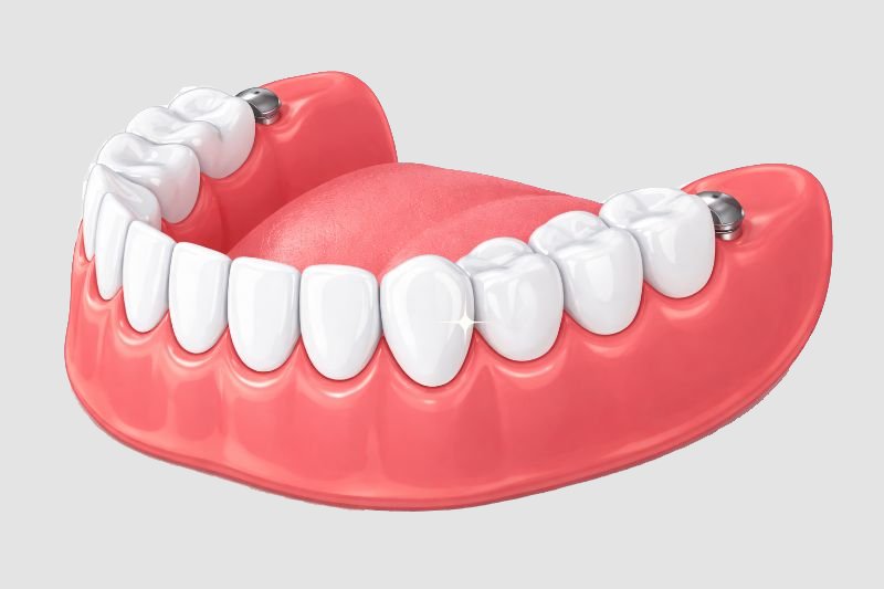 Full & Removable Partial Dentures